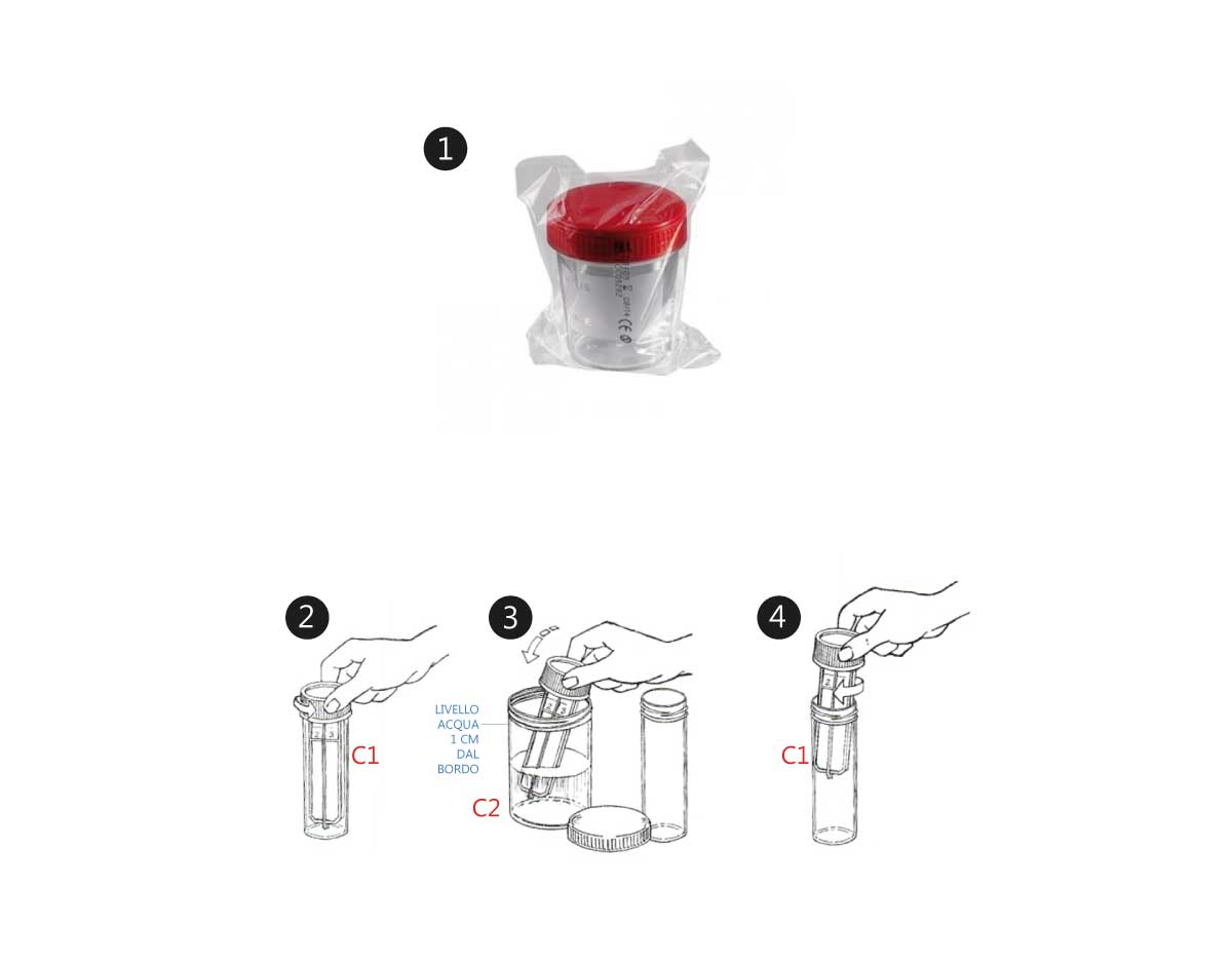 procedimento-acqua-safe-terri-coltura-batteri